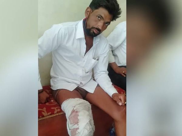 शादी के बीच हर्ष फायर में दूल्हे के