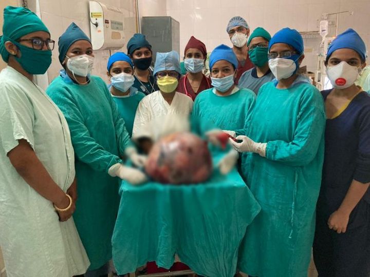 2 महीने से फूलता जा रहा था महिला का