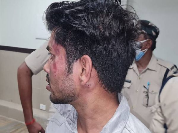 सुपर स्पेशियलिटी में जूनियर डॉक्टरो
