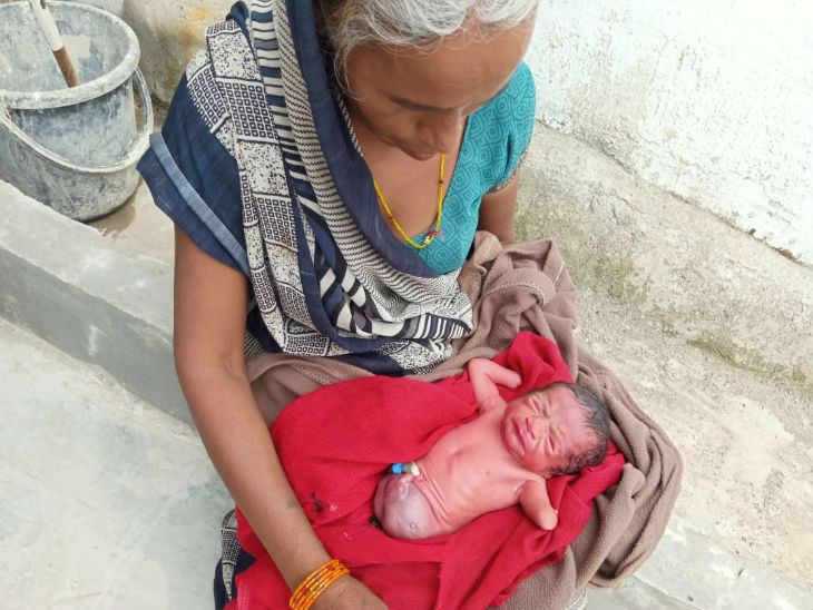 विदिशा में अनोखा बच्चा; महिला ने बि
